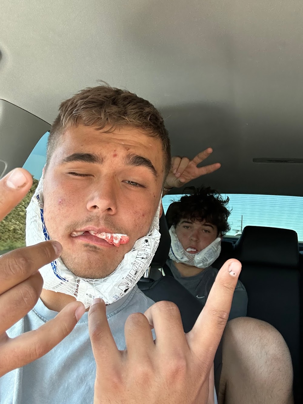 Simply Wisdom Teeth (Cedar CIty)